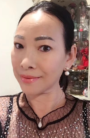 去眼袋手术
