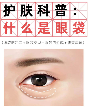 眼袋