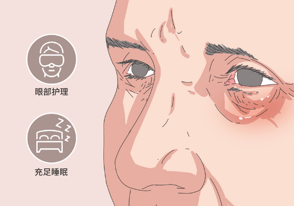 去眼袋手术
