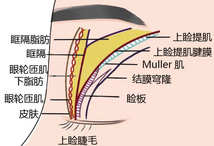 去眼袋手术