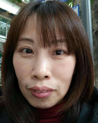 去眼袋手术