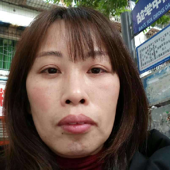 去眼袋手术