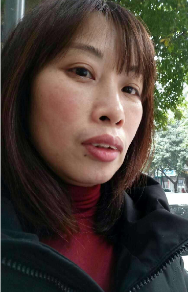去眼袋手术