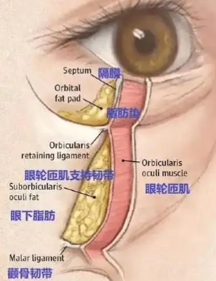 去眼袋手术