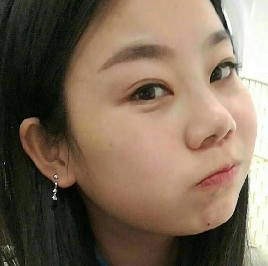 去眼袋手术