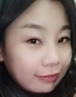 去眼袋手术