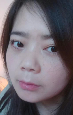 去眼袋手术