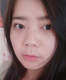 去眼袋手术