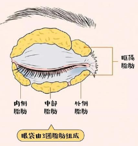 去眼袋手术