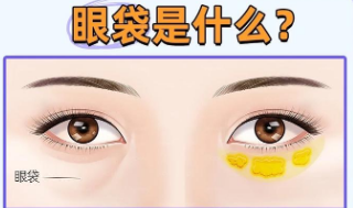 眼袋