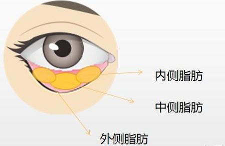 眼袋