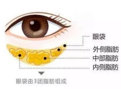 眼袋