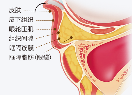 眼袋