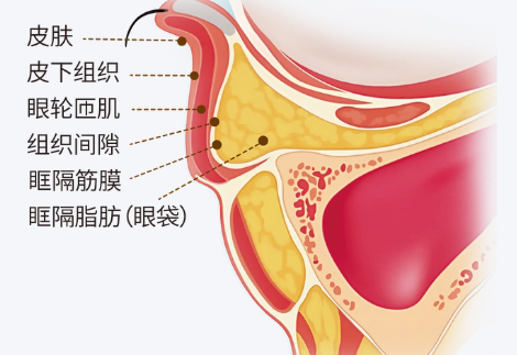 眼袋