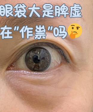 眼袋