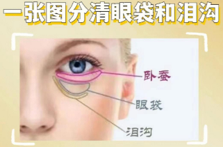 眼袋