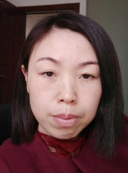 去眼袋手术