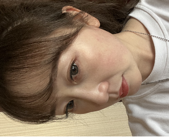 去眼袋手术