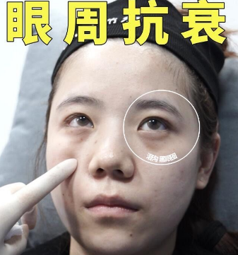 眼袋