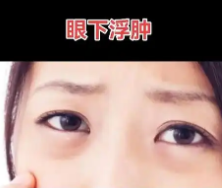 眼袋
