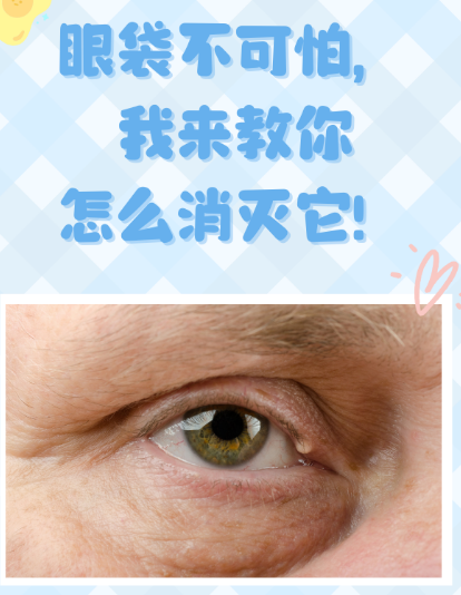 去眼袋手术