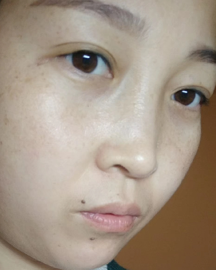 眼袋