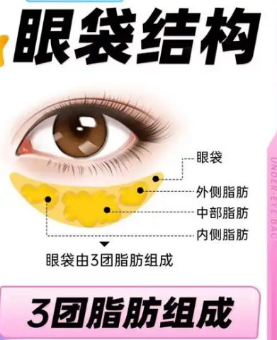 眼袋
