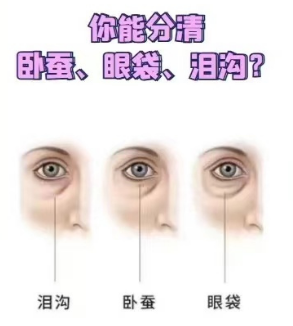眼袋