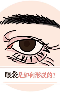 去眼袋手术