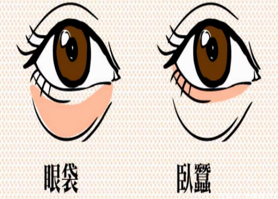 去眼袋手术