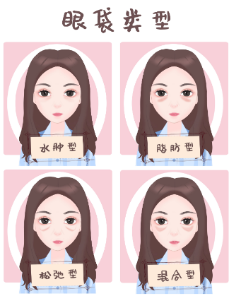 去眼袋手术