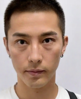 去眼袋手术