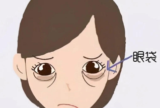 ۴