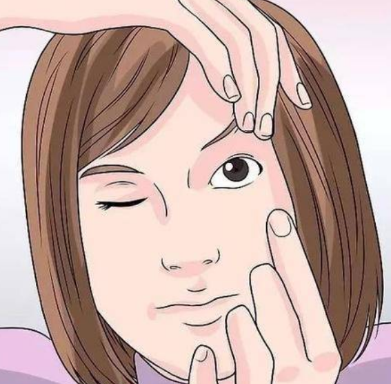 眼袋