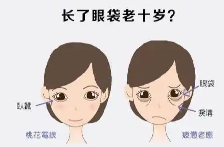去眼袋手术