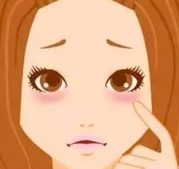 去眼袋手术