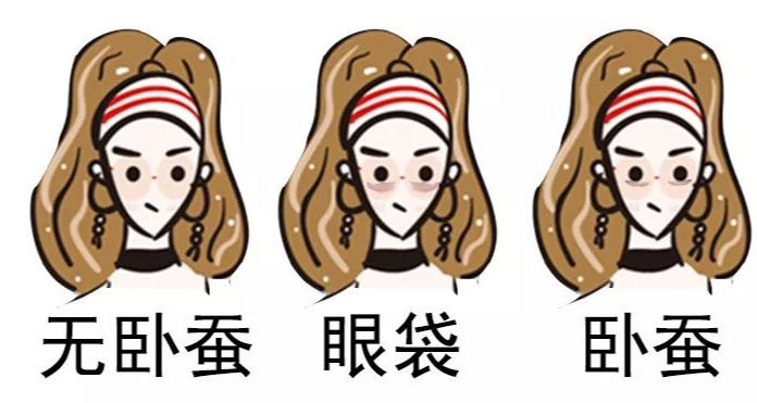 去眼袋手术