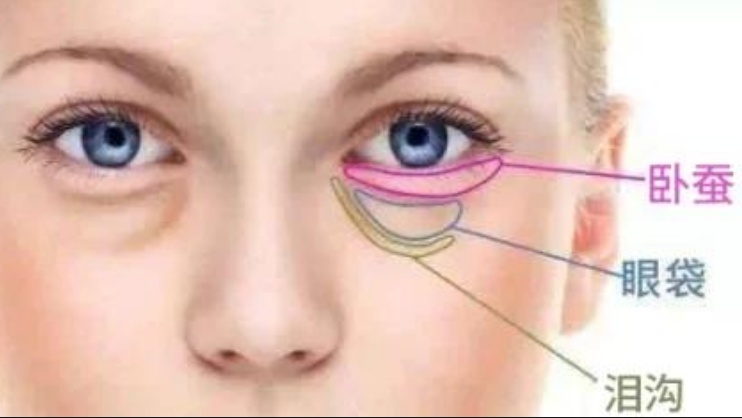去眼袋手术