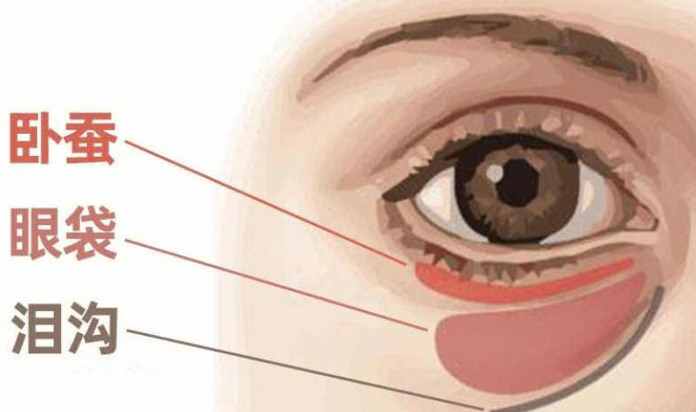 去眼袋手术