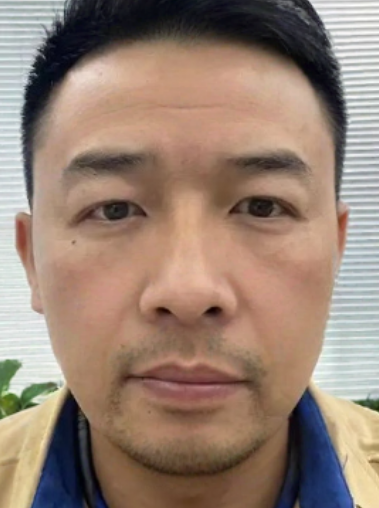 去眼袋手术