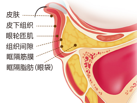 去眼袋手术