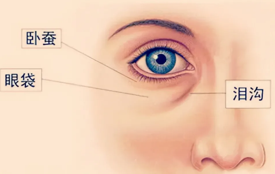 去眼袋手术