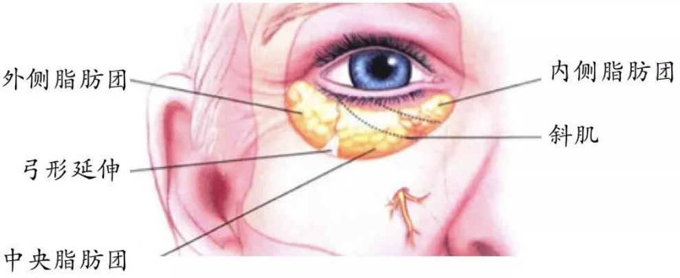 去眼袋手术