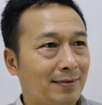 去眼袋手术