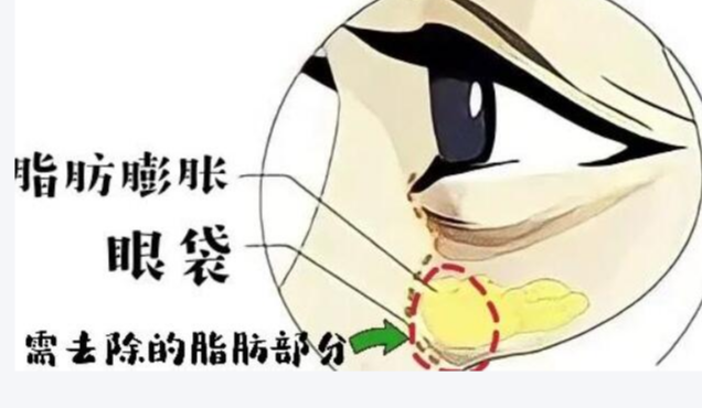 ۴