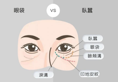 去眼袋手术
