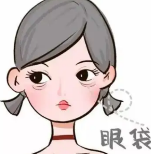 去眼袋手术