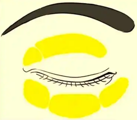 眼袋