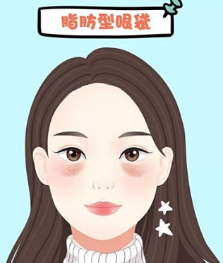 眼袋