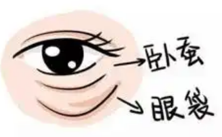 ۴